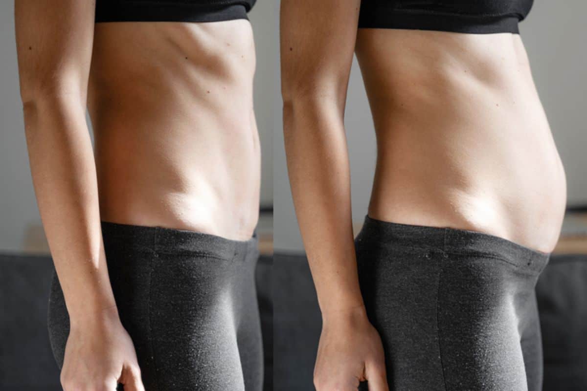 How long does diastasis recti take to improve Liverpool?