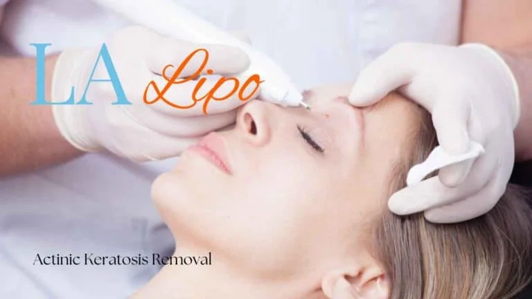 Woman receiving Actinic Keratosis Removal Treatment Liverpool
