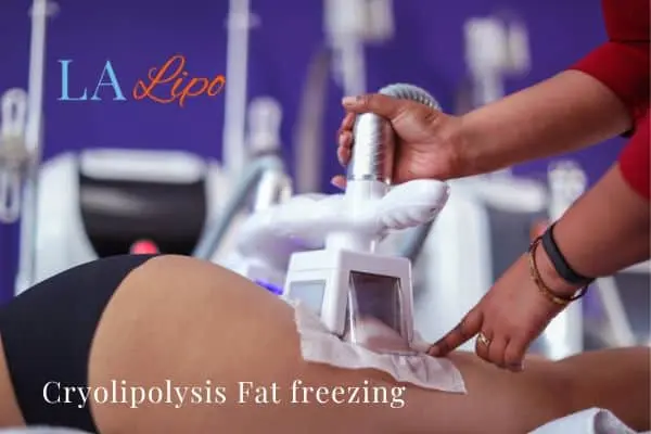 women getting fat freezing Liverpool