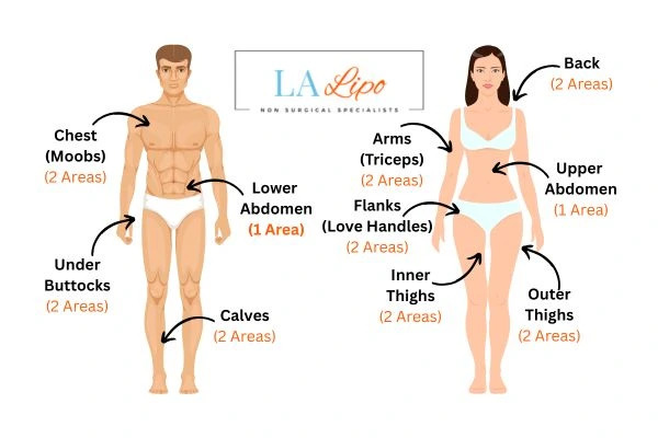 LA LIPO Cryolipolysis Areas Liverpool