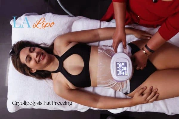 woman getting cryolipolysis Liverpool