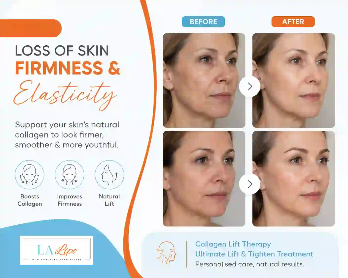 Sign #7: Loss of Skin Firmness and Elasticity Liverpool